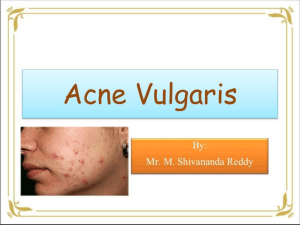 acne-vulgaris-64077369