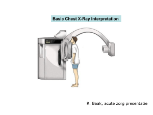 Basic Chest X-Ray Interpretation - HagaZiekenhuis ( PDFDrive )
