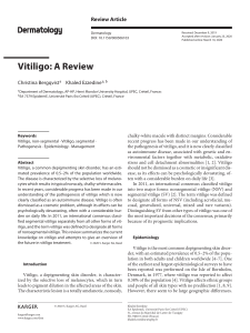 vitiligo a review