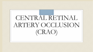 central retinal artery occlusion