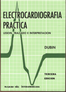 Electrocardiografía: Análisis del Ritmo, Extrasístoles, Fallos