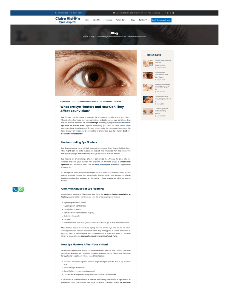 Eye Floaters: Causes, Symptoms & Treatment | Clairevision Eye Care
